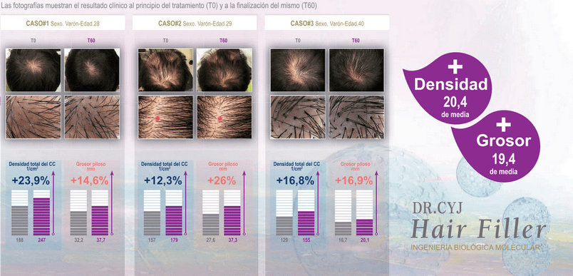 ¿Como funciona el tratamiento Revitalizador - Hair Filler Anticaida y Crecimiento Dr CyJ?