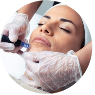 Mesolifting facial con dermapen - Bellezzia clínicas estéticas