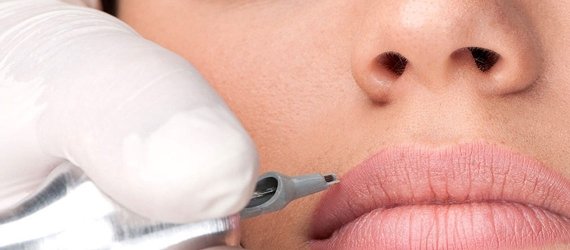 Aumento y remodelado de labios con Ácido Hialurónico