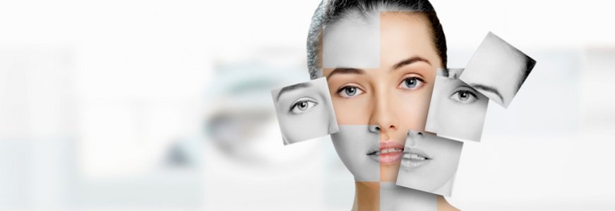 ¿Qué zonas puedo tratar con los hilos tensores a nivel facial?