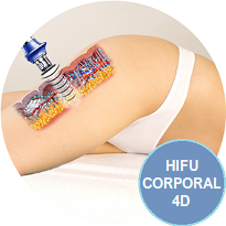 Oferta - Tratamientos Corporales - Hifu 4D