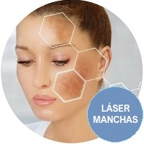  Oferta - Tratamientos Faciales - Eliminacion Manchas Láser