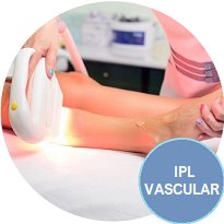 Oferta - Tratamientos Corporales - Arañas vasculares