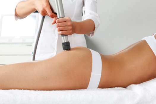 Alimentación, ejercicio y tratamientos específicos: Pilares básicos para combatir la celulitis