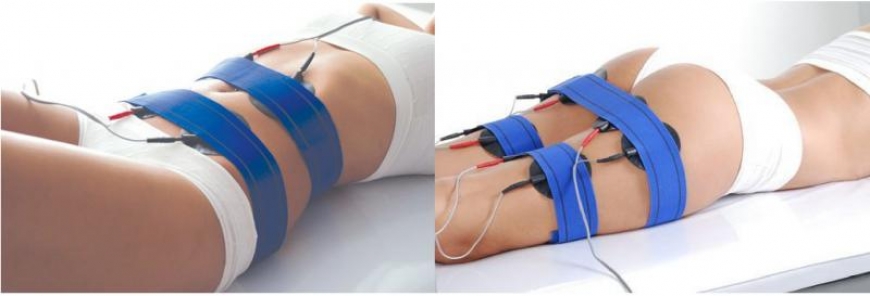 ¿Qué es y para que sirve la Electroestimulación en la estética?