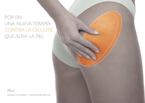 Un nuevo método para tratar la celulitis: Ondas de Choque AWT o Dermoplastia