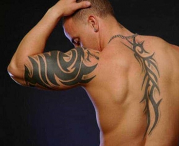 Eliminación de tatuajes en zonas grandes